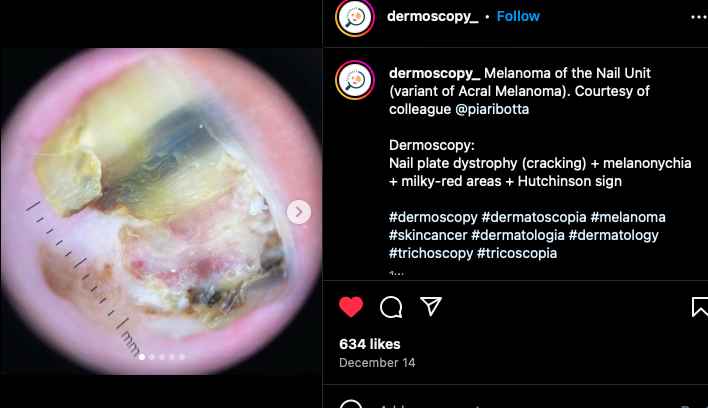 Scalable Genomic Processing: 1,000x Speed Improvement with Distributed Computing